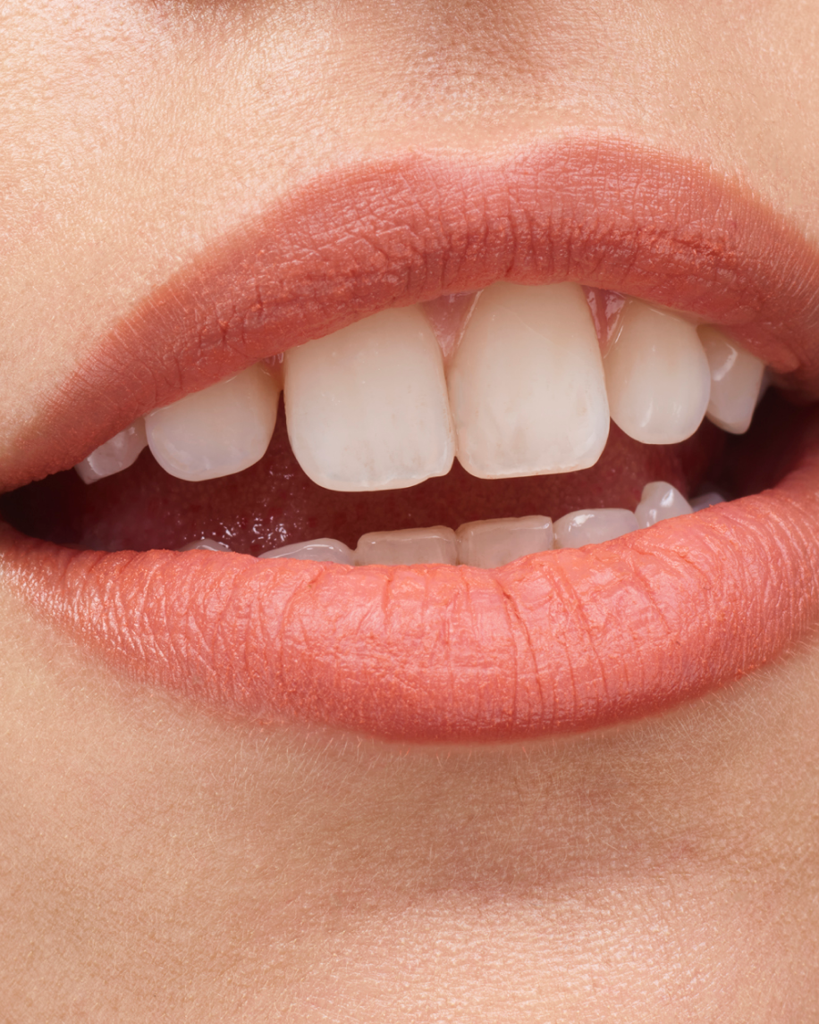 Generation G - 图片 7