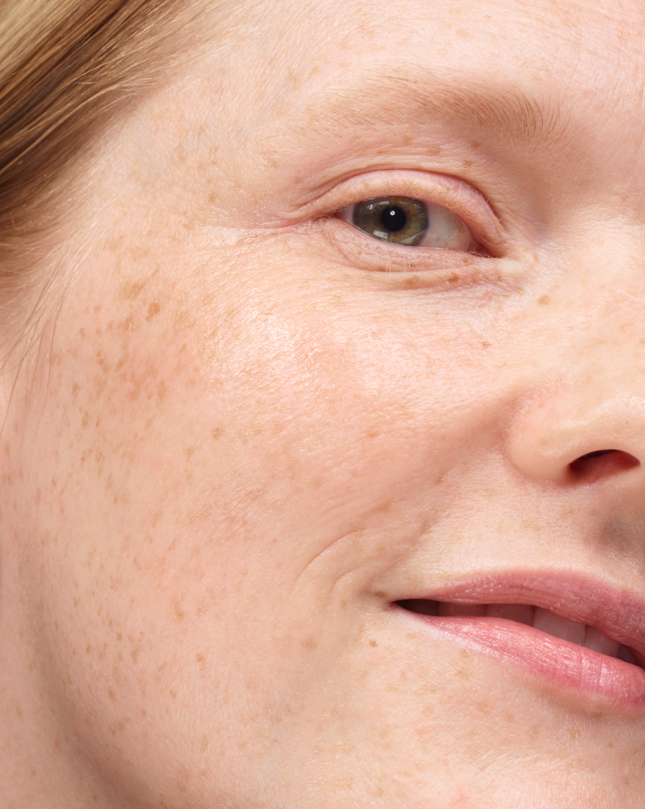 Universal Pro-Retinol - 图片 2